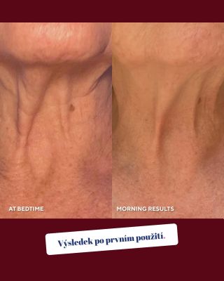 Je fakt, že krk a dekolt jsou jedny z nejnáročnějších částí na péči. Málo se o nich mluví, přitom stárnou jako první. A...